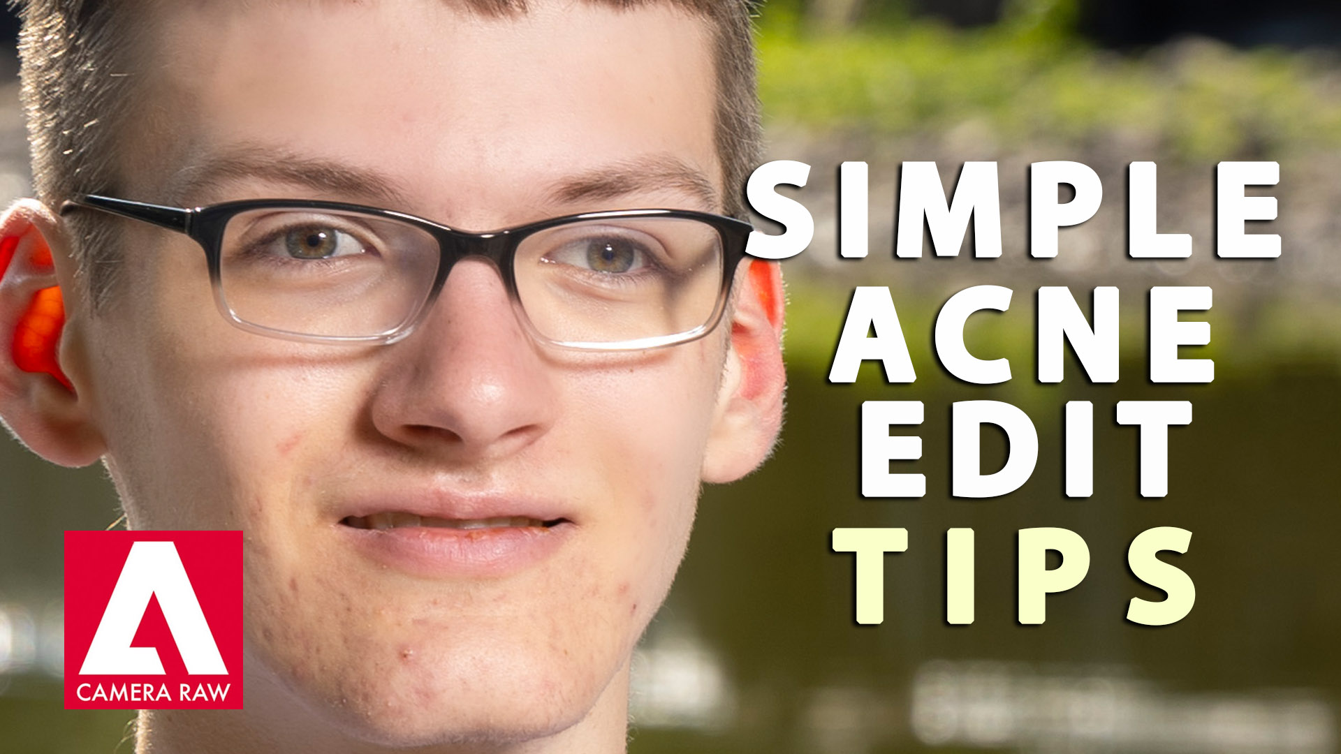 Two Simple Acne Edit Tips